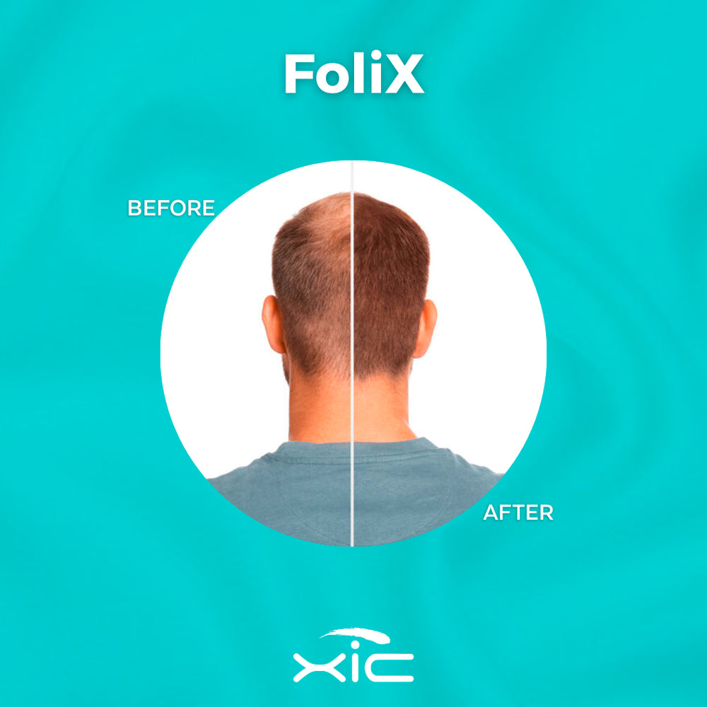XiC Duo Folix