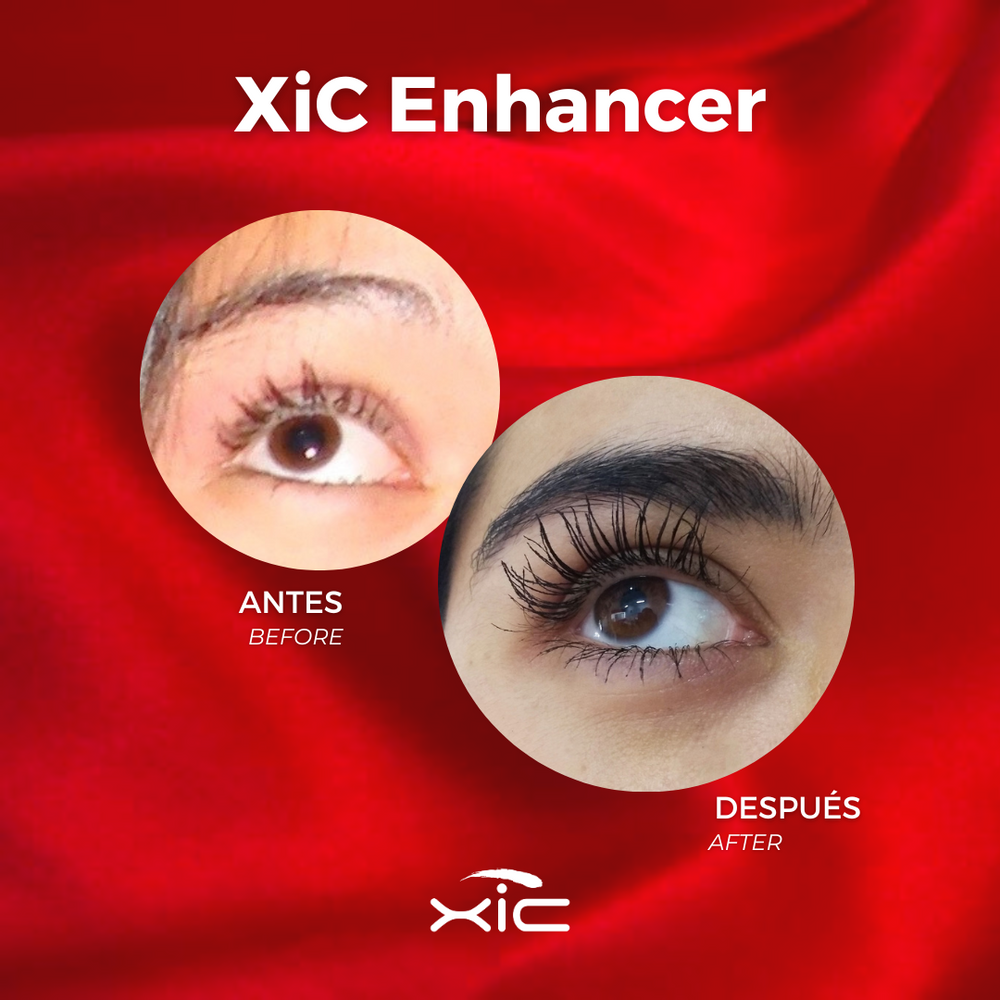XiC Enhancer